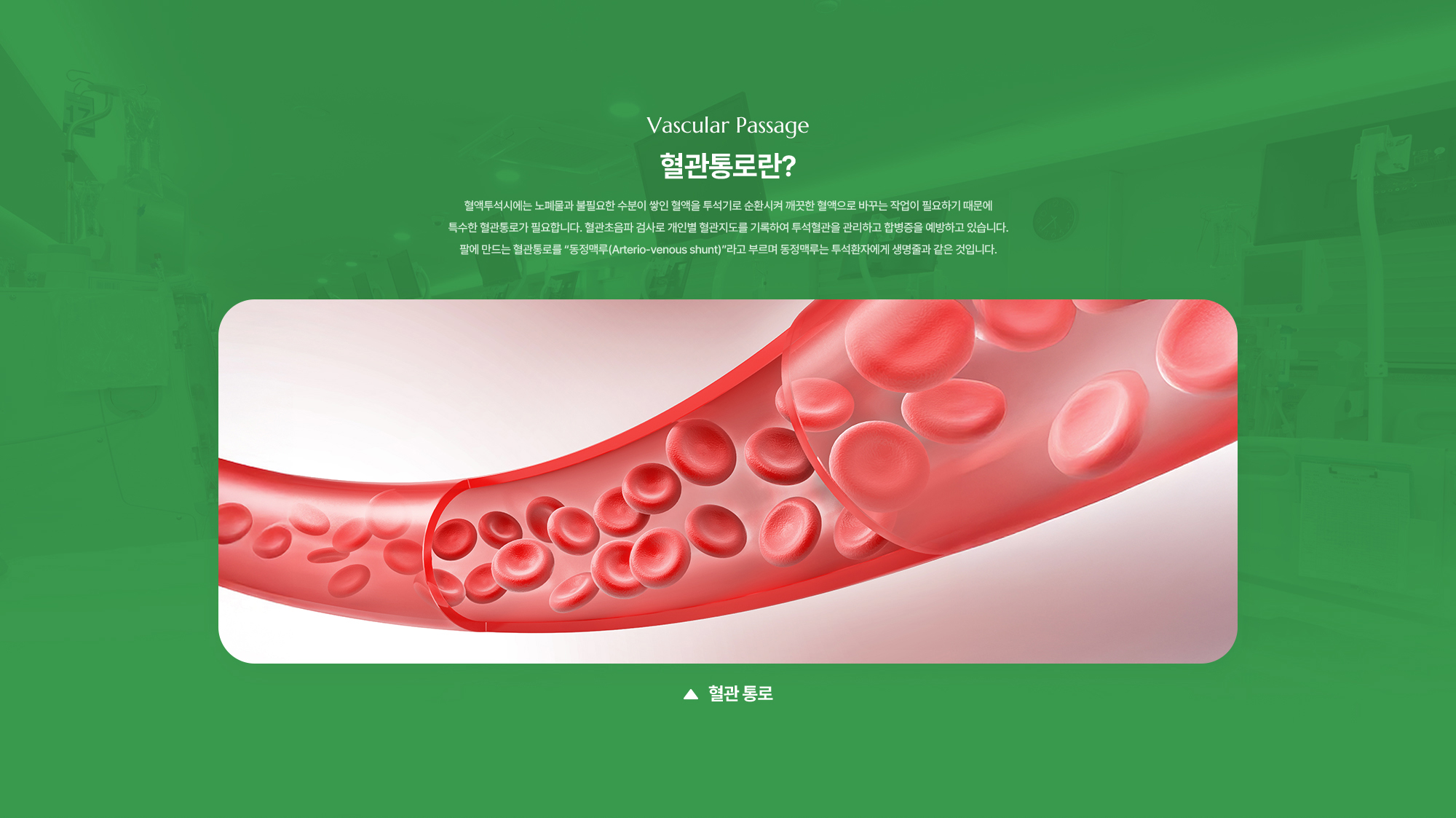 혈관통로란? 혈액투석시에는 노폐물과 불필요한 수분이 쌓인 혈액을 투석기로 순환시켜 깨끗한 혈액으로 바꾸는 작업이 필요하기 때문에 특수한 혈관통로가 필요합니다. 혈관초음파 검사로 개인별 혈관지도를 기록하여 투석혈관을 관리하고 합병증을 예방하고 있습니다. 팔에 만드는 혈관통로를 “동정맥루(Arterio-venous shunt)”라고 부르며 동정맥루는 투석환자에게 생명줄과 같은 것입니다.